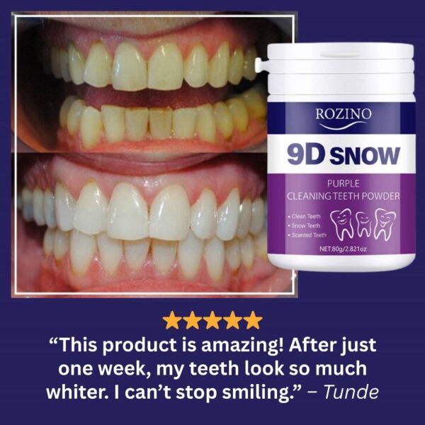 9D snow teeth powder